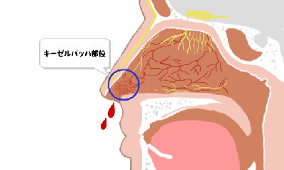 イメージ画